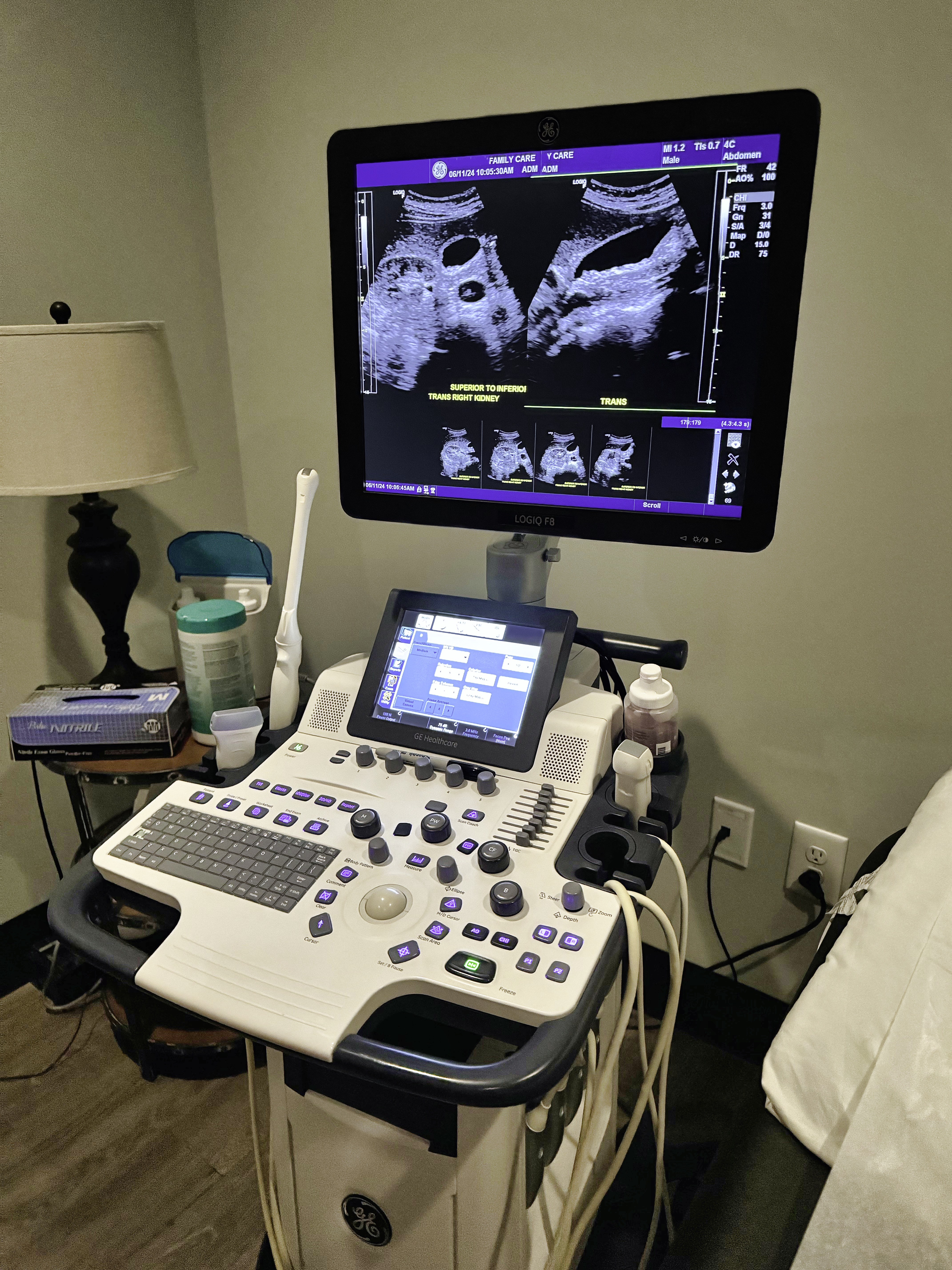 Medical ultrasound scanner